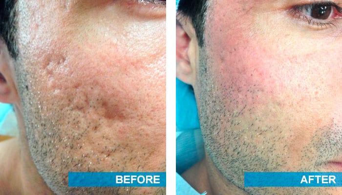 SUNSHINE COSMETIC CLINIC & MEDI SPA