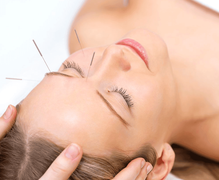 We offer acupuncture facial in Waterloo Kitchener area. Contact us for more details!