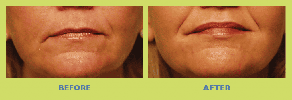 SUNSHINE COSMETIC CLINIC & MEDI SPA