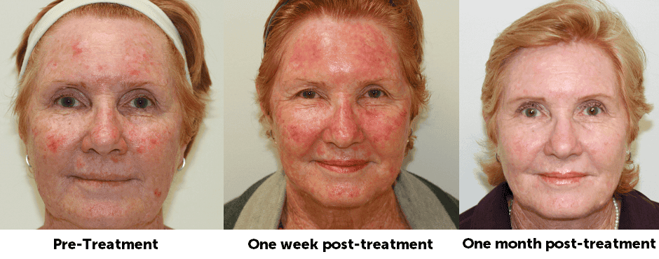 SUNSHINE COSMETIC CLINIC & MEDI SPA