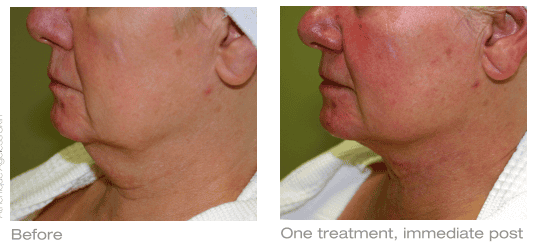 SUNSHINE COSMETIC CLINIC & MEDI SPA