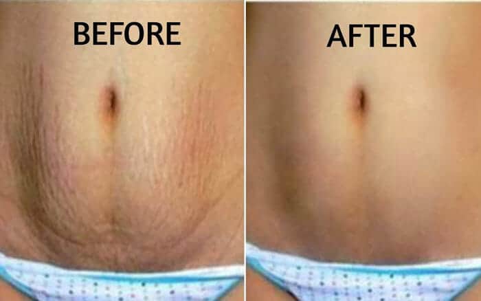 SUNSHINE COSMETIC CLINIC & MEDI SPA