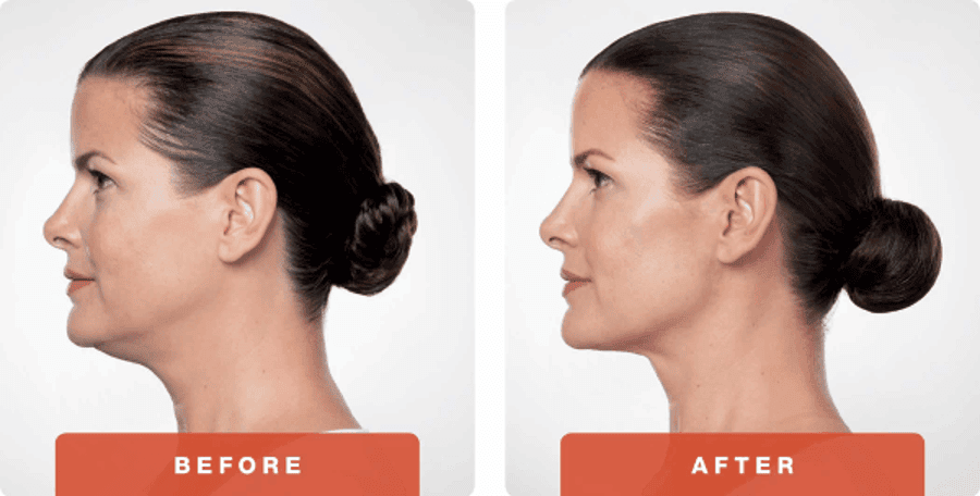 SUNSHINE COSMETIC CLINIC & MEDI SPA