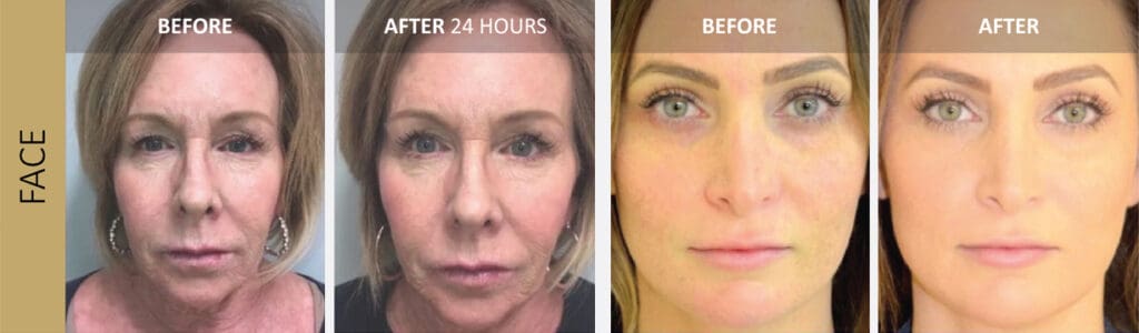 SUNSHINE COSMETIC CLINIC & MEDI SPA