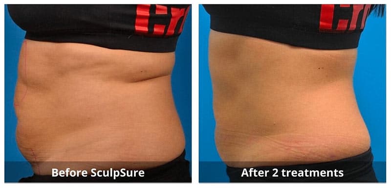 SUNSHINE COSMETIC CLINIC & MEDI SPA
