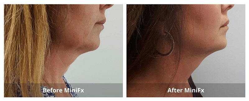 SUNSHINE COSMETIC CLINIC & MEDI SPA