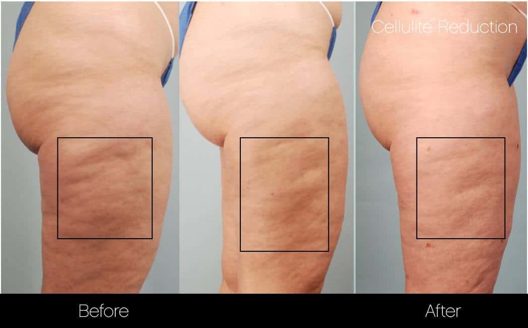 SUNSHINE COSMETIC CLINIC & MEDI SPA