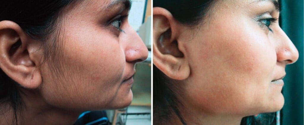 SUNSHINE COSMETIC CLINIC & MEDI SPA