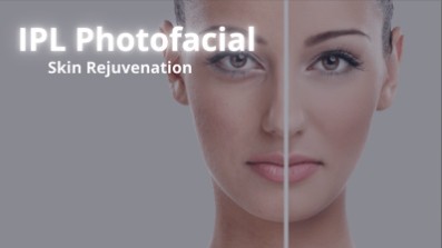 IPL is a non-invasive skin rejuvenation procedure. We provide the best IPL in Waterloo Kitchener area.