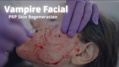SUNSHINE COSMETIC CLINIC & MEDI SPA