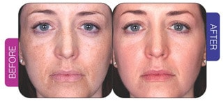 SUNSHINE COSMETIC CLINIC & MEDI SPA