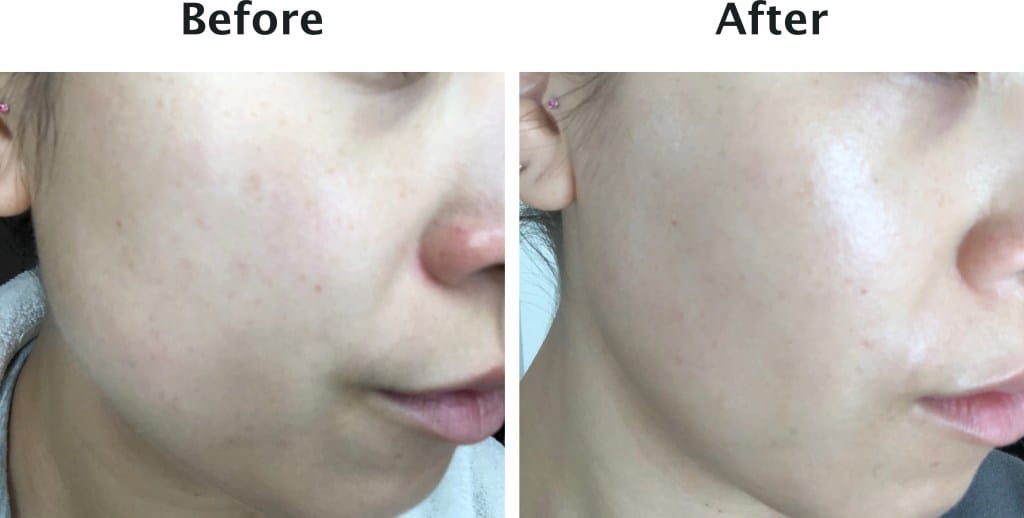 SUNSHINE COSMETIC CLINIC & MEDI SPA