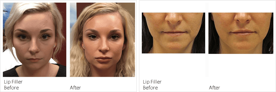 SUNSHINE COSMETIC CLINIC & MEDI SPA