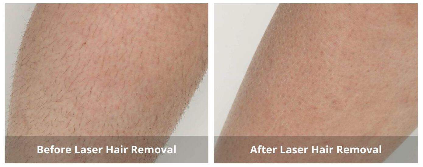 SUNSHINE COSMETIC CLINIC & MEDI SPA