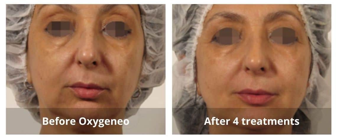 SUNSHINE COSMETIC CLINIC & MEDI SPA