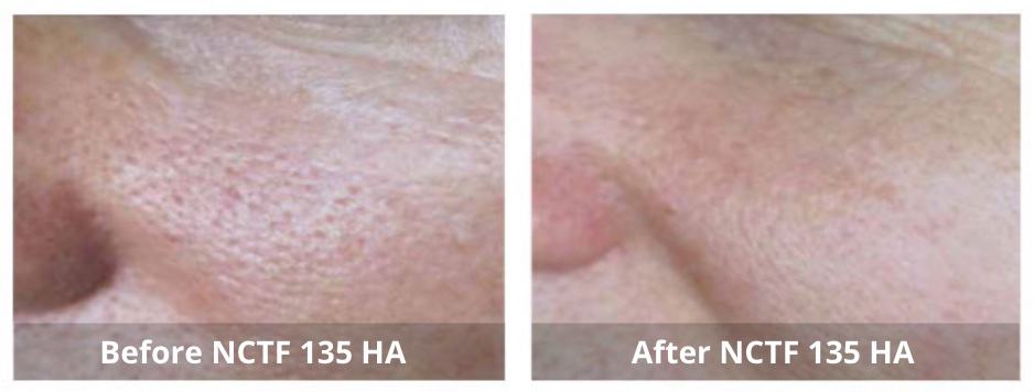 SUNSHINE COSMETIC CLINIC & MEDI SPA