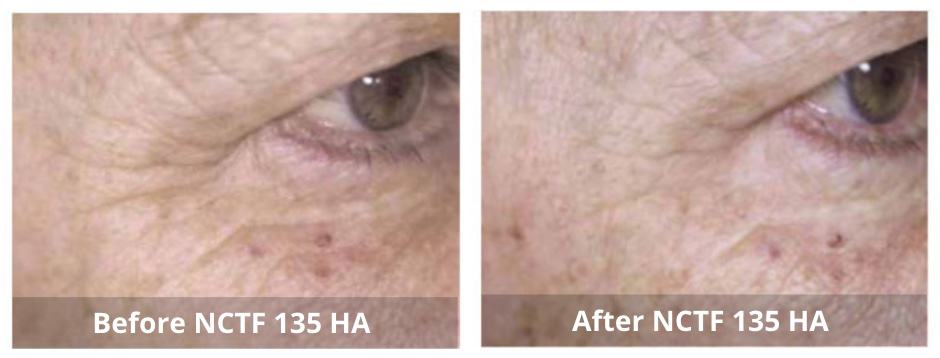 SUNSHINE COSMETIC CLINIC & MEDI SPA