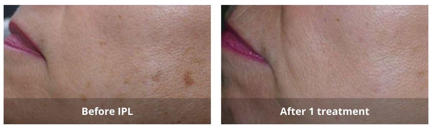 SUNSHINE COSMETIC CLINIC & MEDI SPA