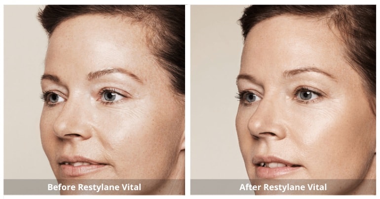 SUNSHINE COSMETIC CLINIC & MEDI SPA