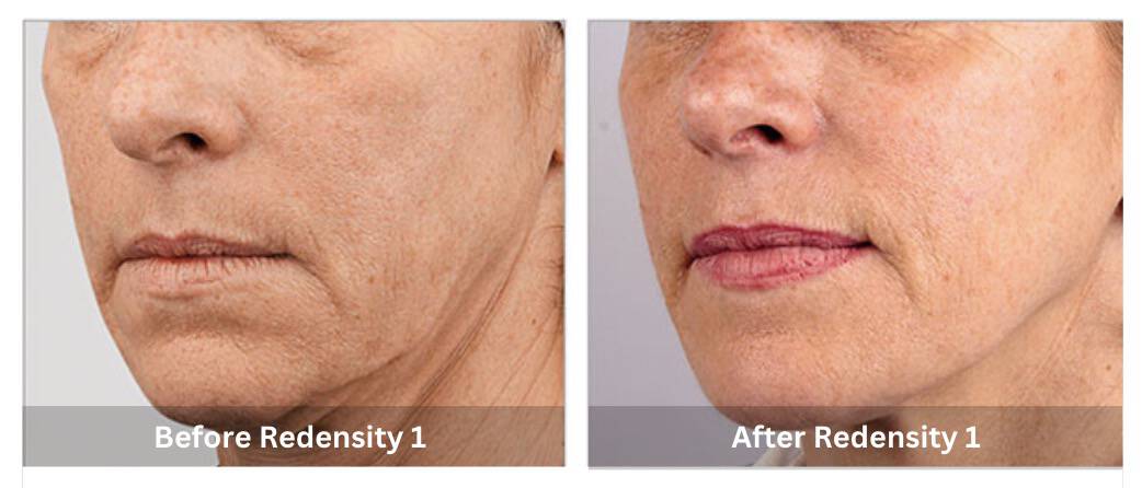 SUNSHINE COSMETIC CLINIC & MEDI SPA