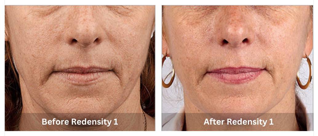 SUNSHINE COSMETIC CLINIC & MEDI SPA