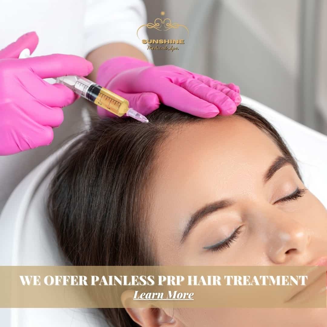 We offer painless prp treatment for hair loss in Kitchener Waterloo area.