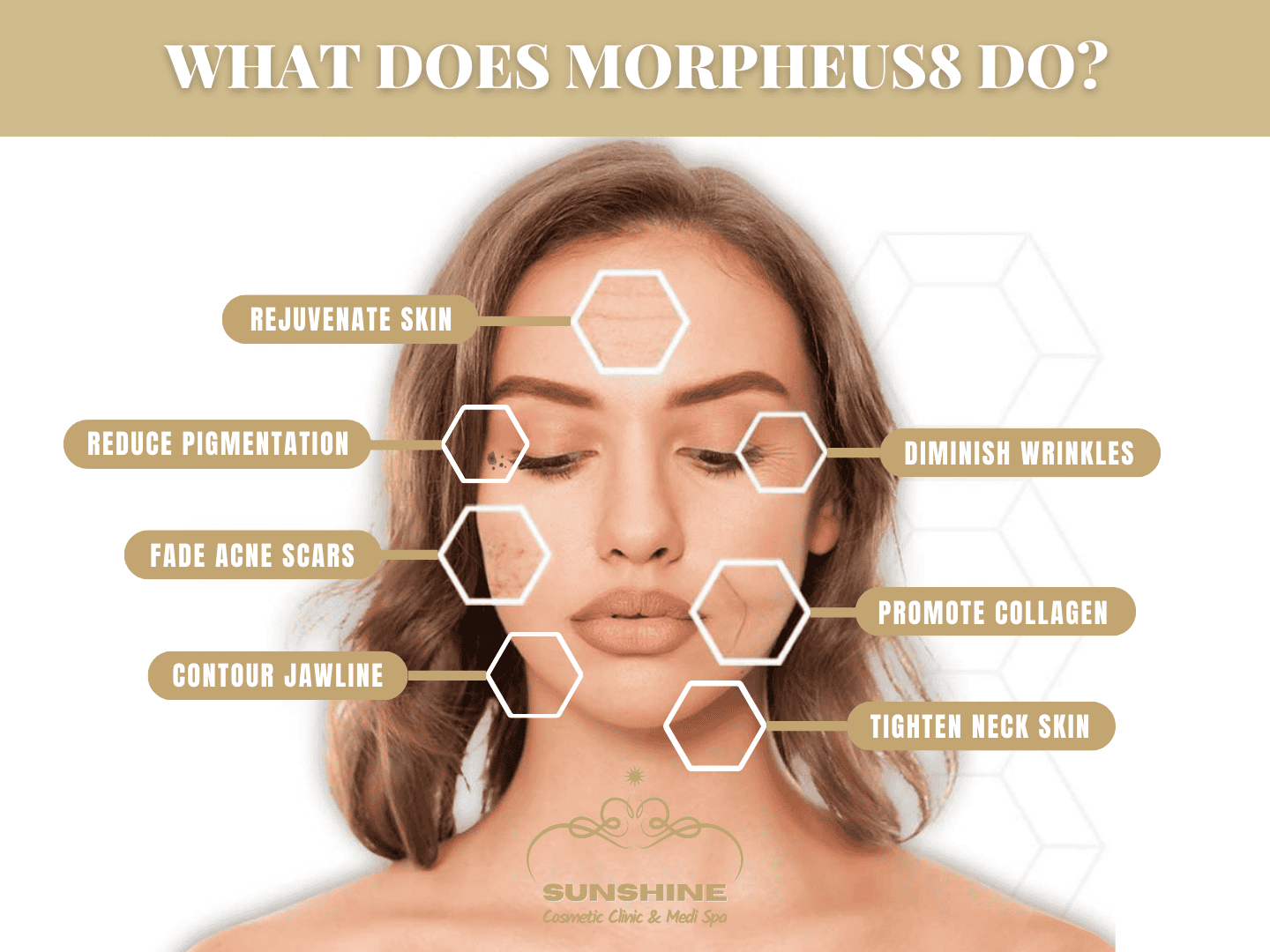 What does Morpheus8 do? Explained by Morpheus8 expert in Kitchener Waterloo area