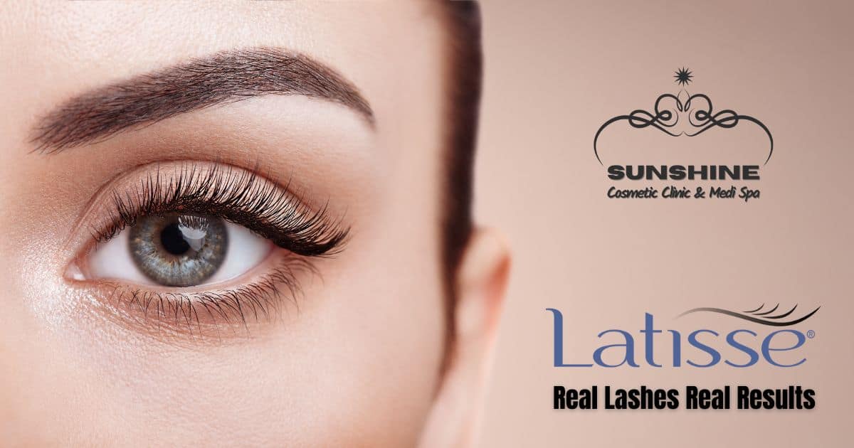 latisse treatment in waterloo kitchener cambridge ontario