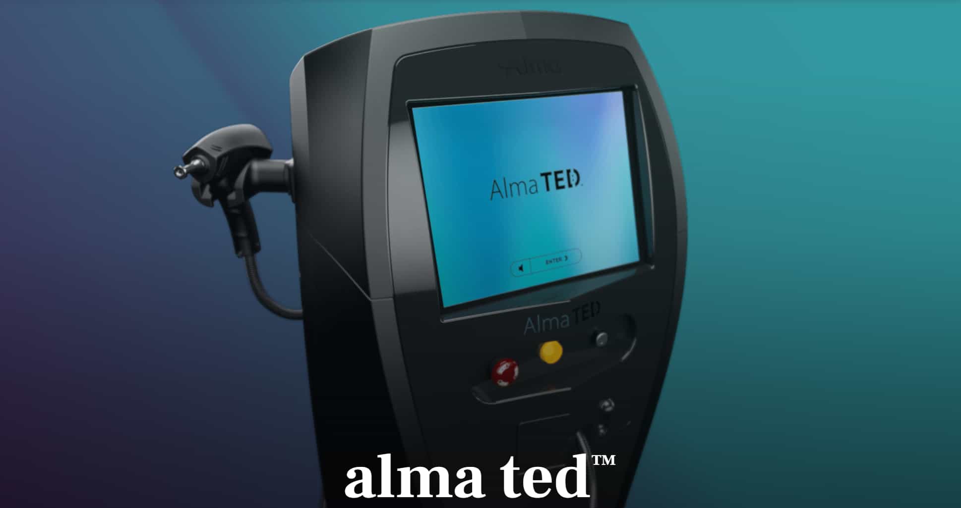 Alma TED hair restoration kitchener waterloo cambridge ontario