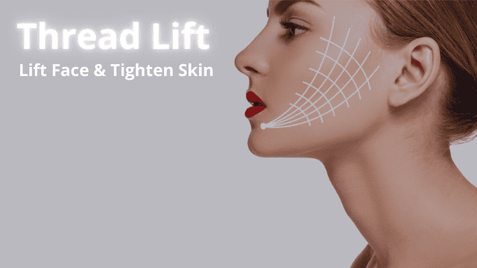 Thread lift in Kitchener Waterloo Cambridge area