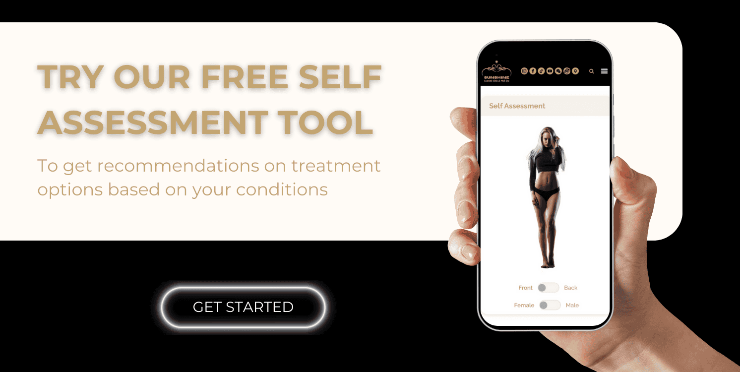 try out self assessment tool for your skin concerns in kitchener waterloo area