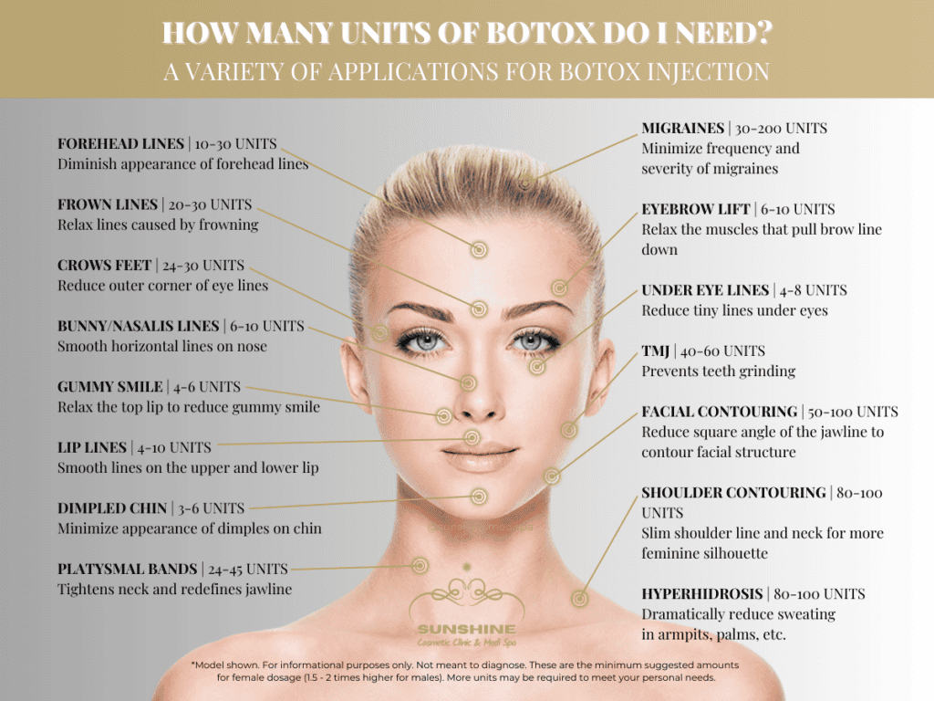 Recommended Botox injection dosage for our clients in Kitchener Waterloo area.