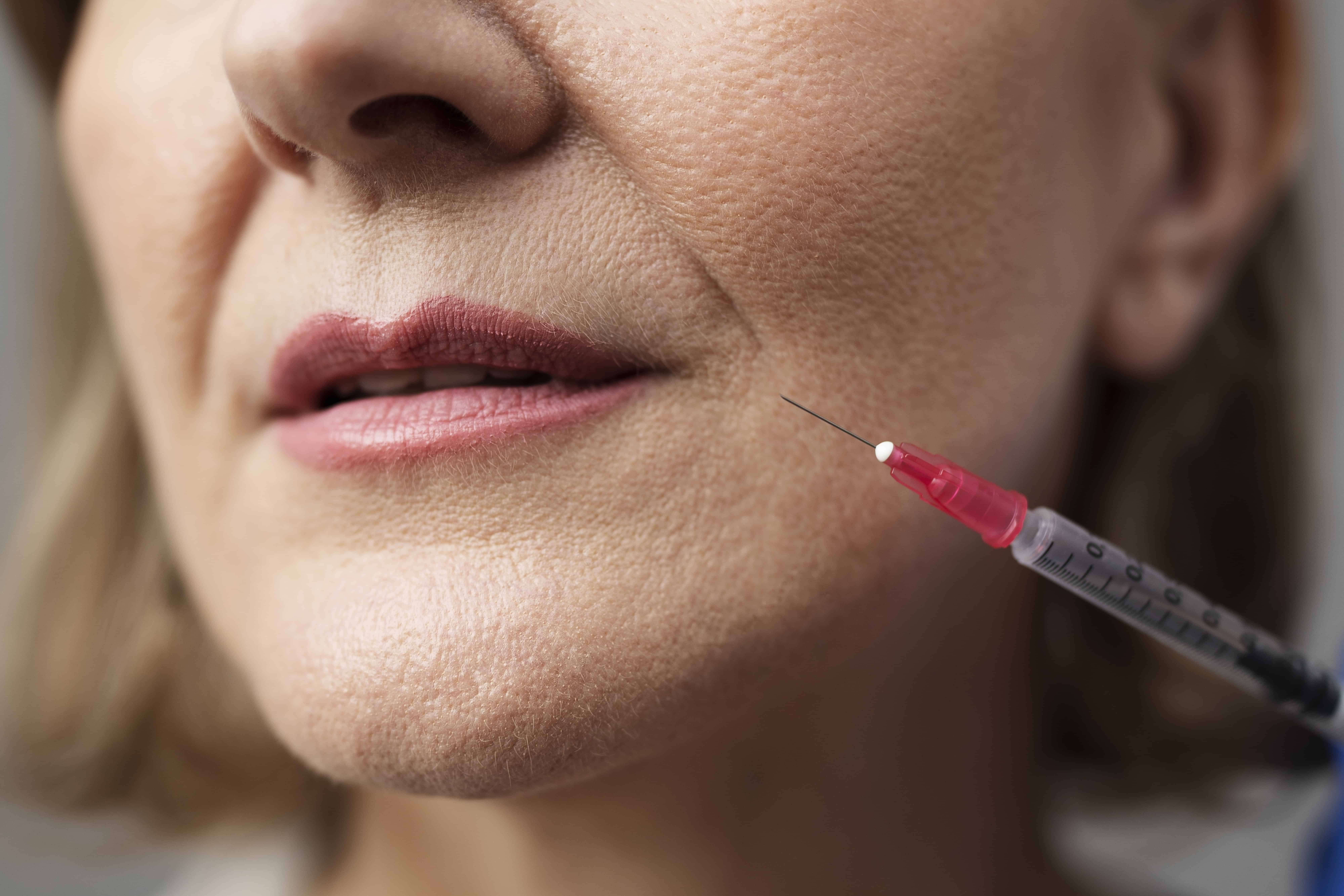 Dermal Fillers in Waterloo