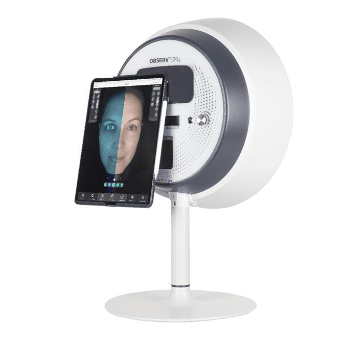observ520-skin-analyzer-waterloo-kitchener
