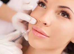 Lip Filler in Waterloo: Everything You Need to Know | Waterloo, ON | Sunshine Cosmetic Clinic & Medi Spa