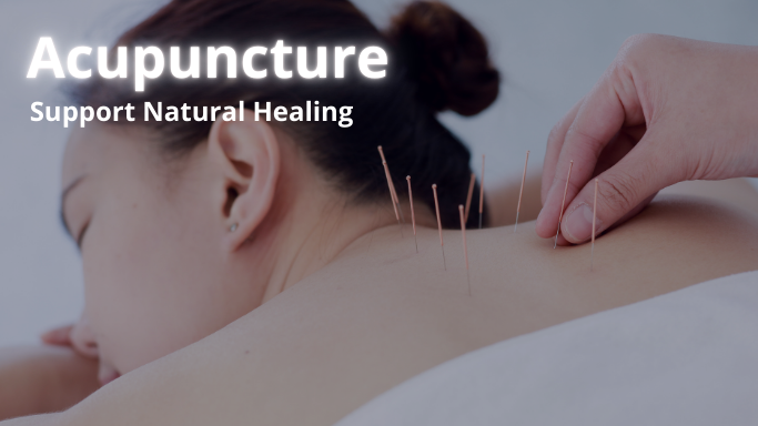 We offer acupuncture in waterloo kitchener cambridge ontario as one of our wellness treatments