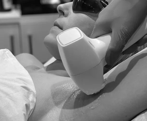 Laser Hair Removal in Waterloo